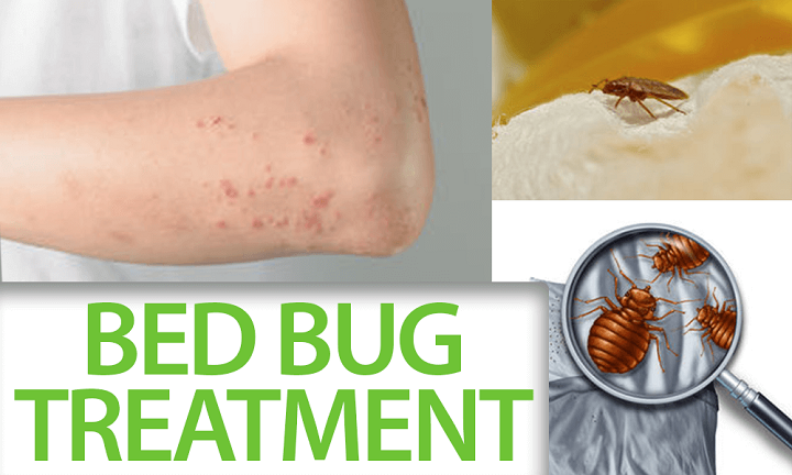 What Not To Use As A Bed Bug Treatment.